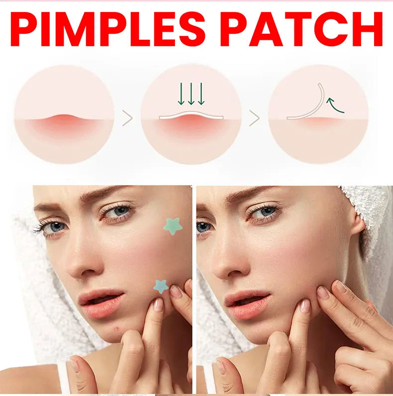 Effective Acne Repair Patch for Fading Blemishes - Smarsty