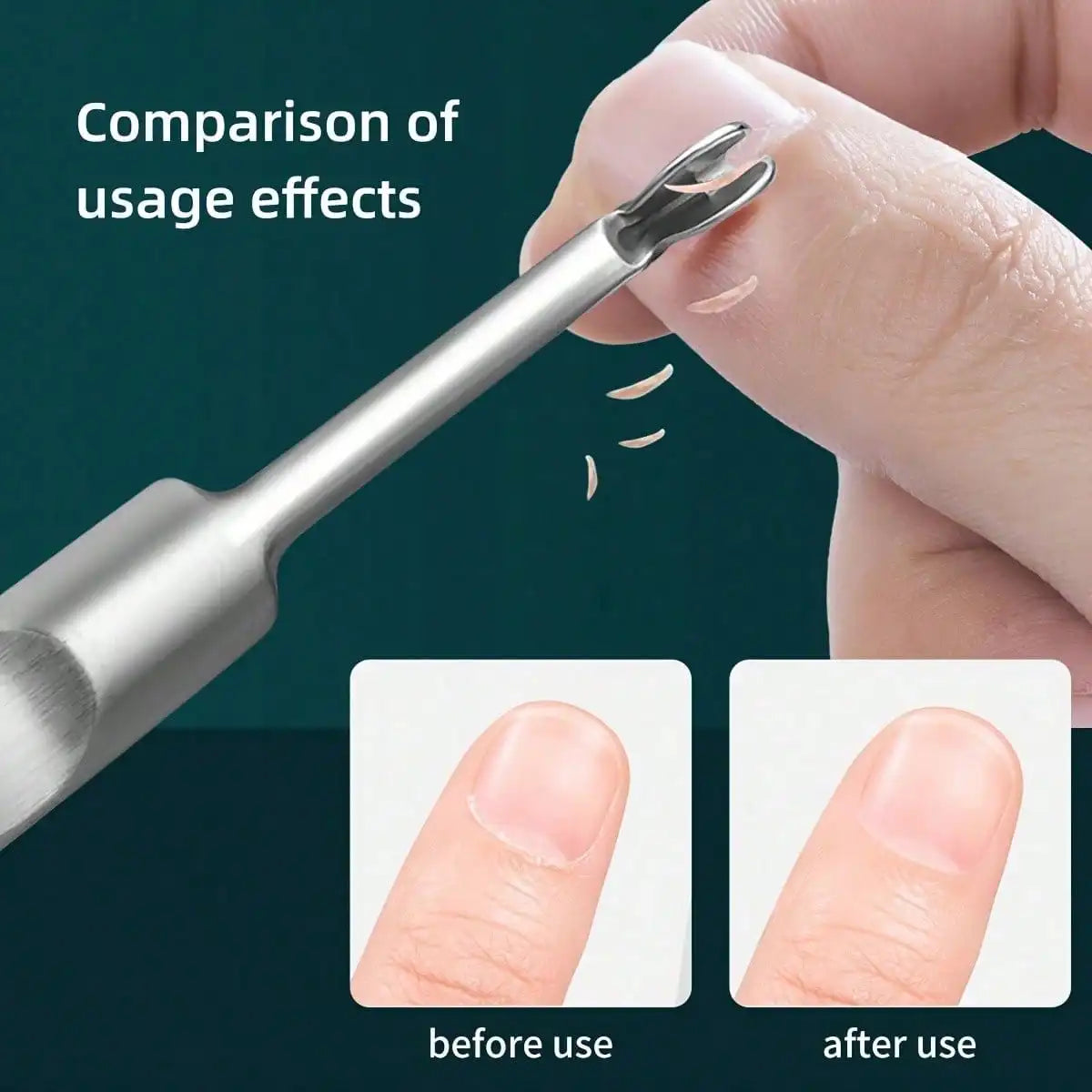 Stainless Steel Nail Care Set for Smooth Cuticle Removal - Smarsty
