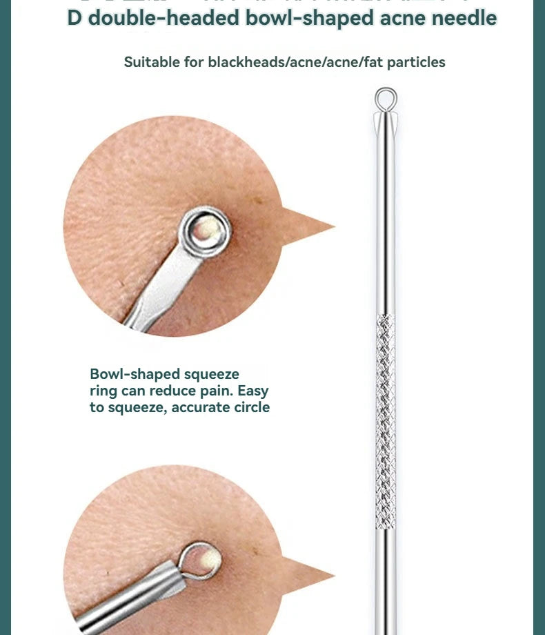 4 Piece Acne Blackhead Removal Needle Set - Smarsty