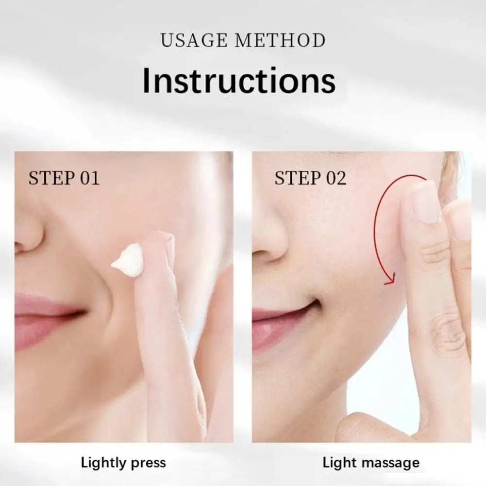 Whitening Freckle Cream for Dark Spot Removal - Smarsty