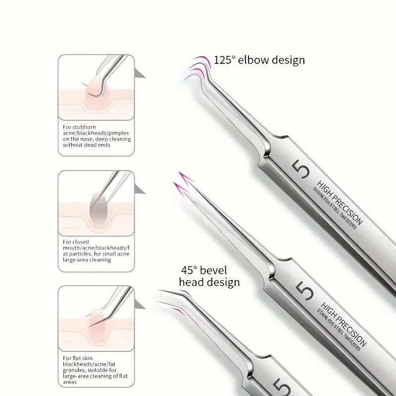 Stainless Steel Blackhead Remover Kit for Clear Skin - Smarsty