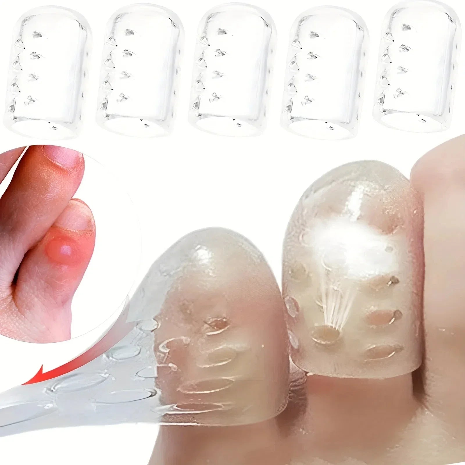 Silicone Toe Cap Protectors for Pain Relief and Bunion Correction - Smarsty