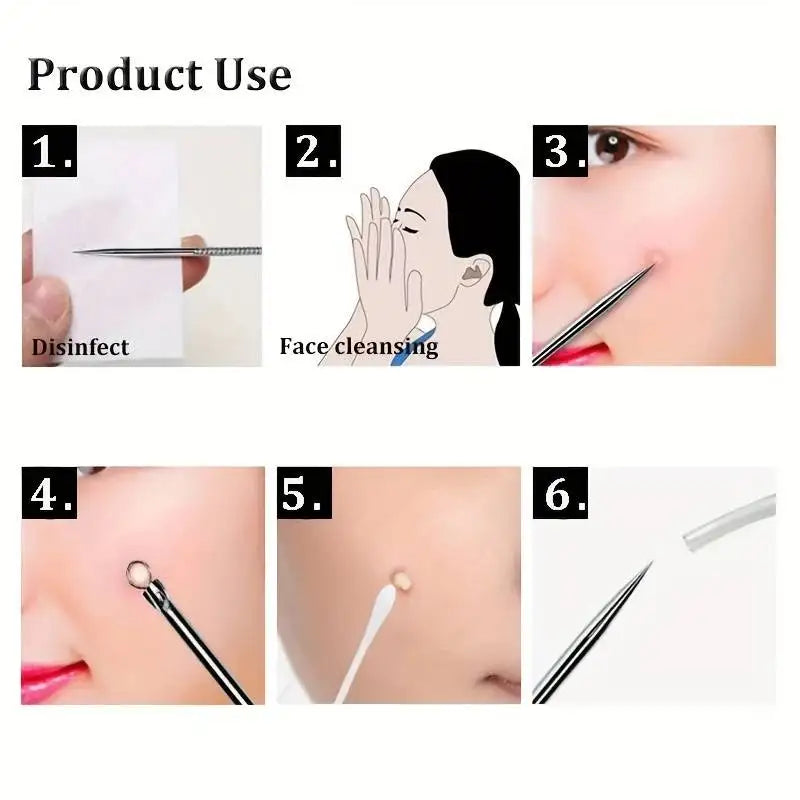 4 Piece Acne Blackhead Removal Needle Set - Smarsty