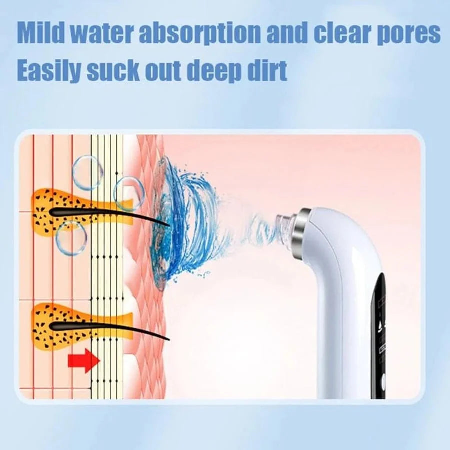 USB Rechargeable Pore Vacuum Blackhead Remover Tool - Smarsty