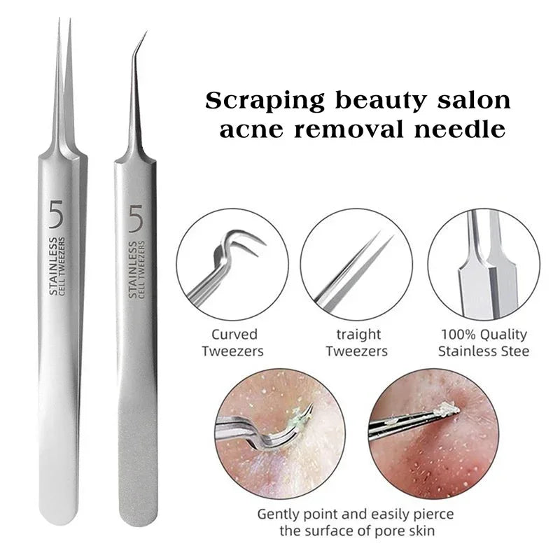 German Ultra Fine Blackhead Remover Tool for Clear Skin - Smarsty