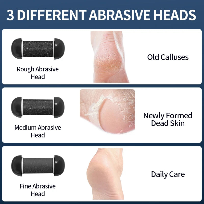 Rechargeable Electric Foot Grinder - USB Powered Callus Remover with Adjustable Speeds, for Men & Women's Pedicure and Self-Care - Smarsty