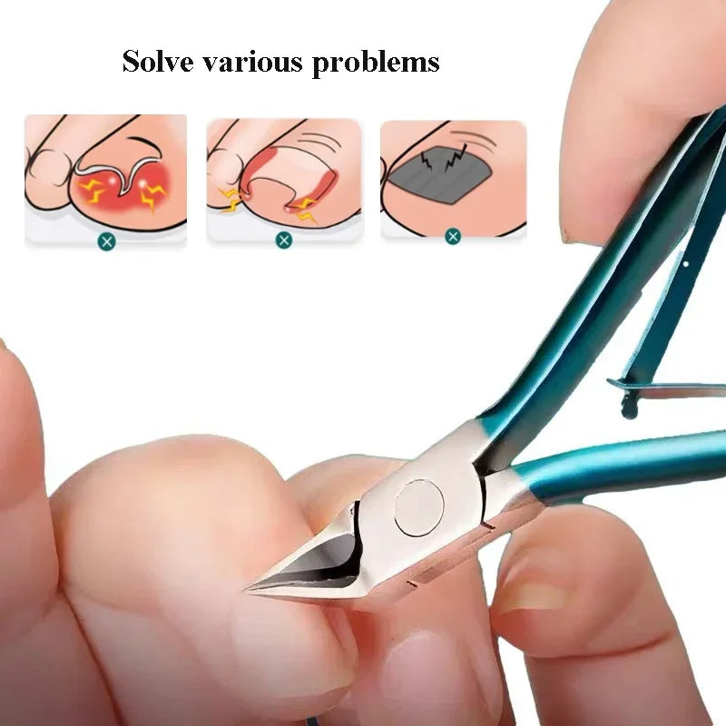 Stainless Steel Toe Nail Clippers for Ingrown Nails - Smarsty
