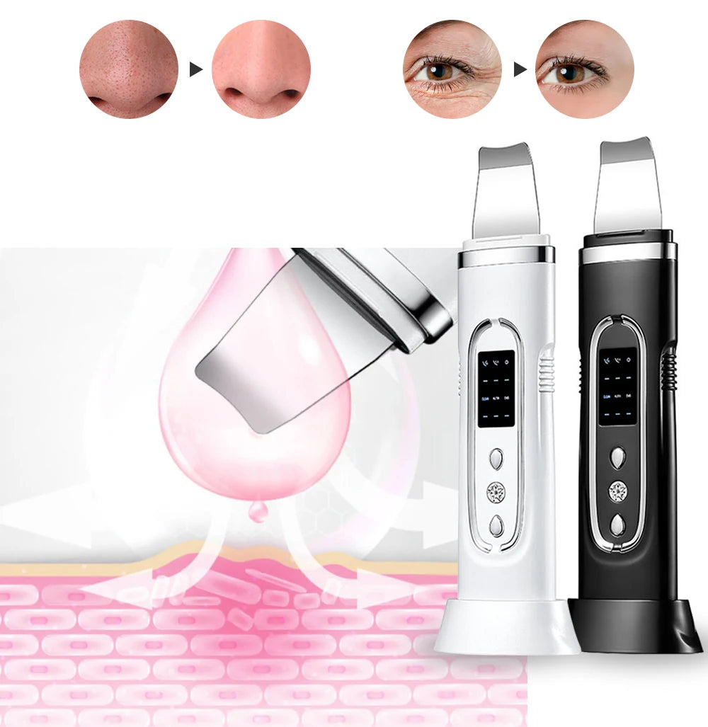 Ultrasonic Skin Scrubber for Deep Cleansing and Rejuvenation - Smarsty