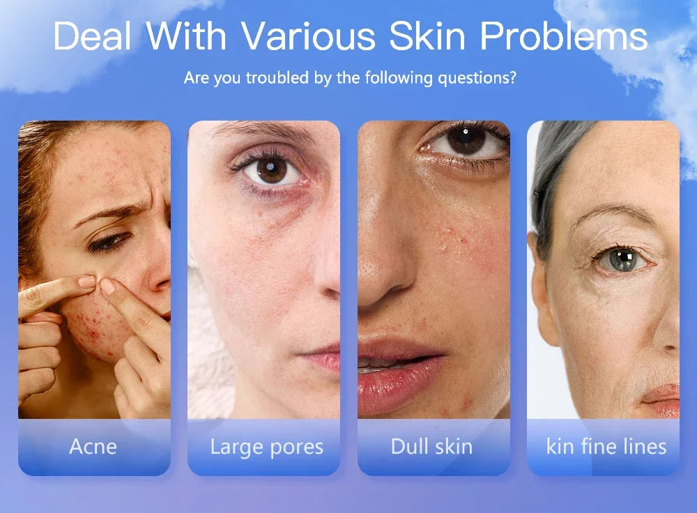 Portable Rechargeable Skin Analyzer for Moisture Detection - Smarsty