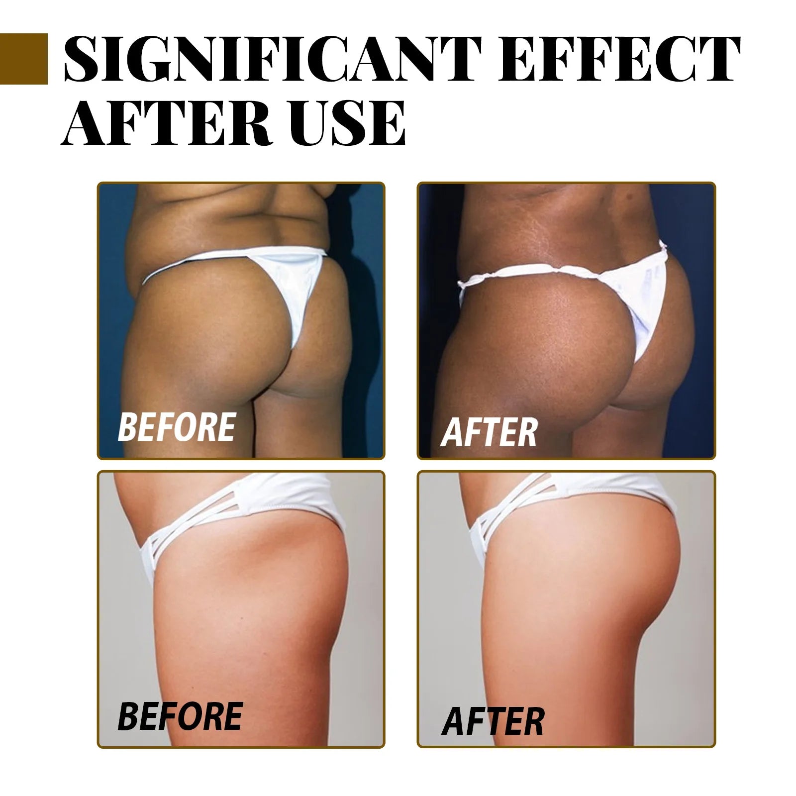 Butt Enhancement Essential Oil for Lifting and Firming - Smarsty