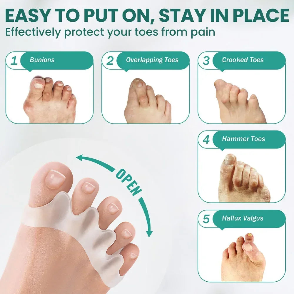 Silicone Toe Separators for Bunion Correction and Foot Comfort - Smarsty