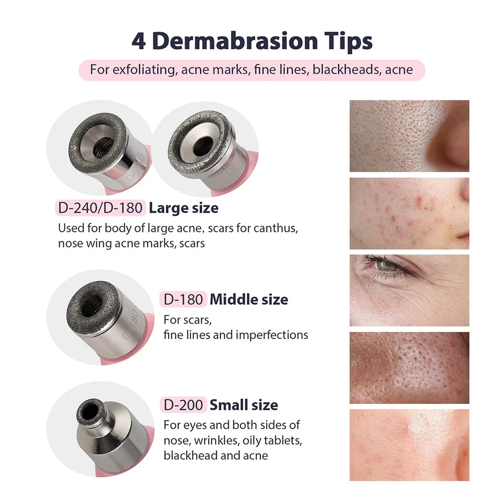 Professional Diamond Microdermabrasion Machine for Home Use - Smarsty