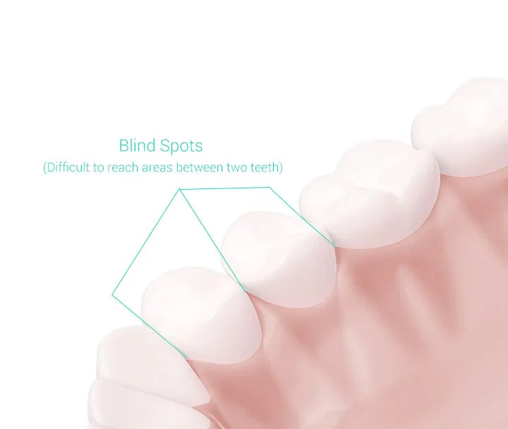 Xiaomi Mijia T300 Sonic Electric Toothbrush with 25 Days Battery Life - Smarsty