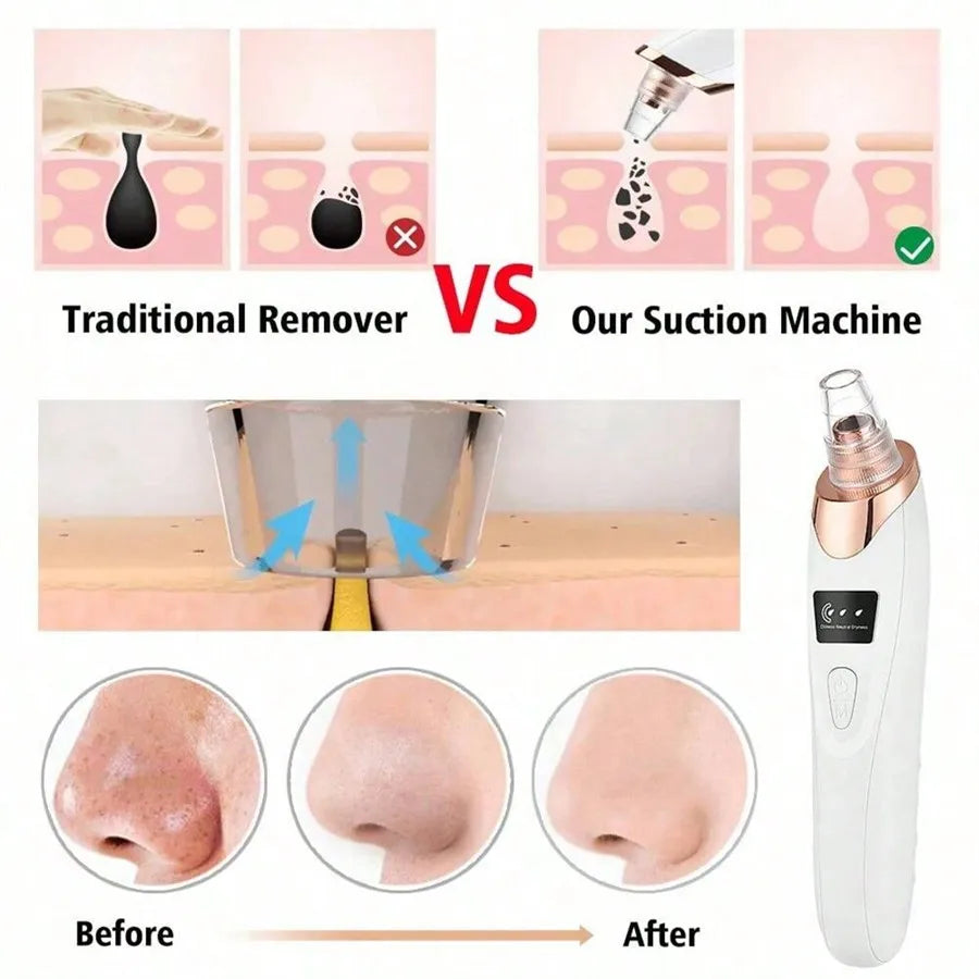 Electric Facial Skin Care Pore Vacuum Blackhead Remover - Smarsty