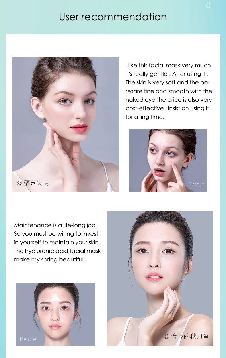 Hyaluronic Acid Hydrating Facial Mask 10 Pack - Smarsty