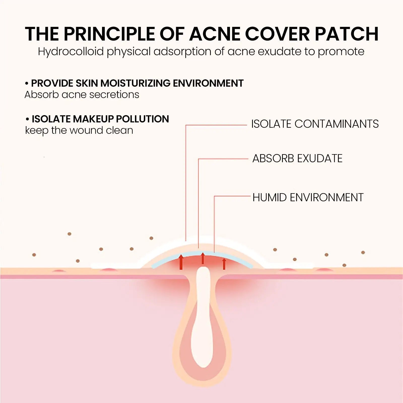 240 pieces of multi-color star acne patches, facial acne patches, concealer acne patches, and pimples patches, ultra-thin - Smarsty