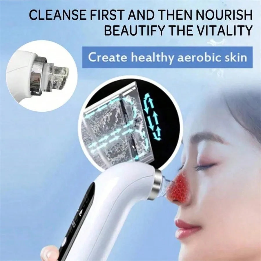 USB Rechargeable Pore Vacuum Blackhead Remover Tool - Smarsty