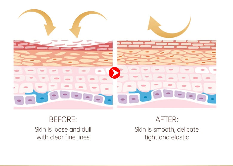 O'CHEAL Eye Moisturizing Cream for Dark Circles and Puffiness - Smarsty