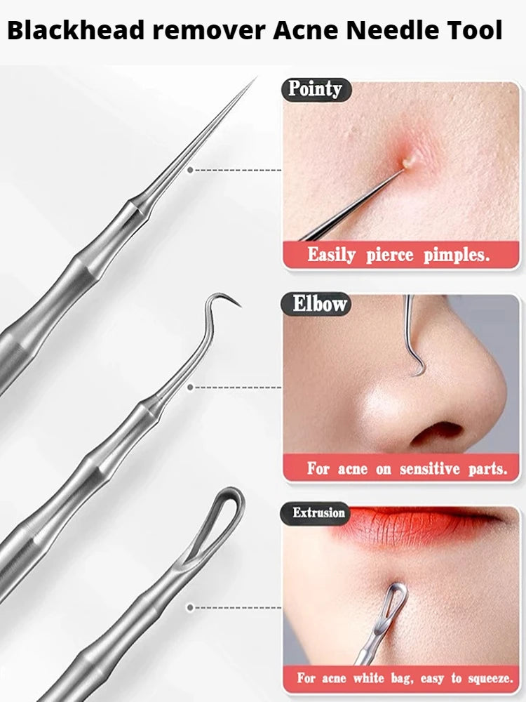 German Blackhead Removal Needle Tool for Clear Skin - Smarsty