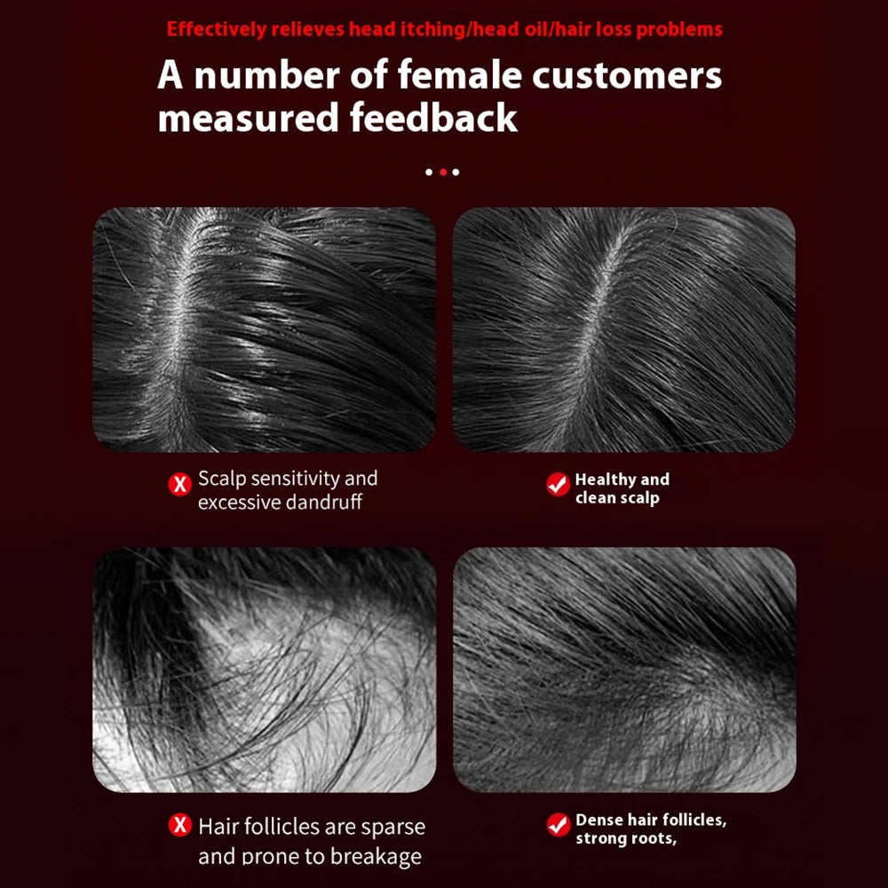 Electric Head Massager Comb for Hair Growth and Relaxation - Smarsty