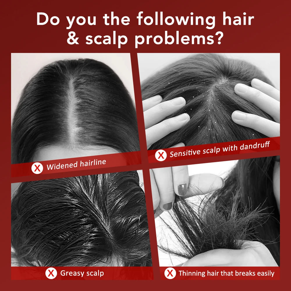 Electric Head Massager Comb for Hair Growth and Relaxation - Smarsty