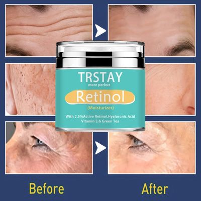 TRSTAY Retinol Moisturizing Cream 2.5% Active Hyaluronic Acid Vitamin E Green Tea Face Cream Nourishing Skin Care