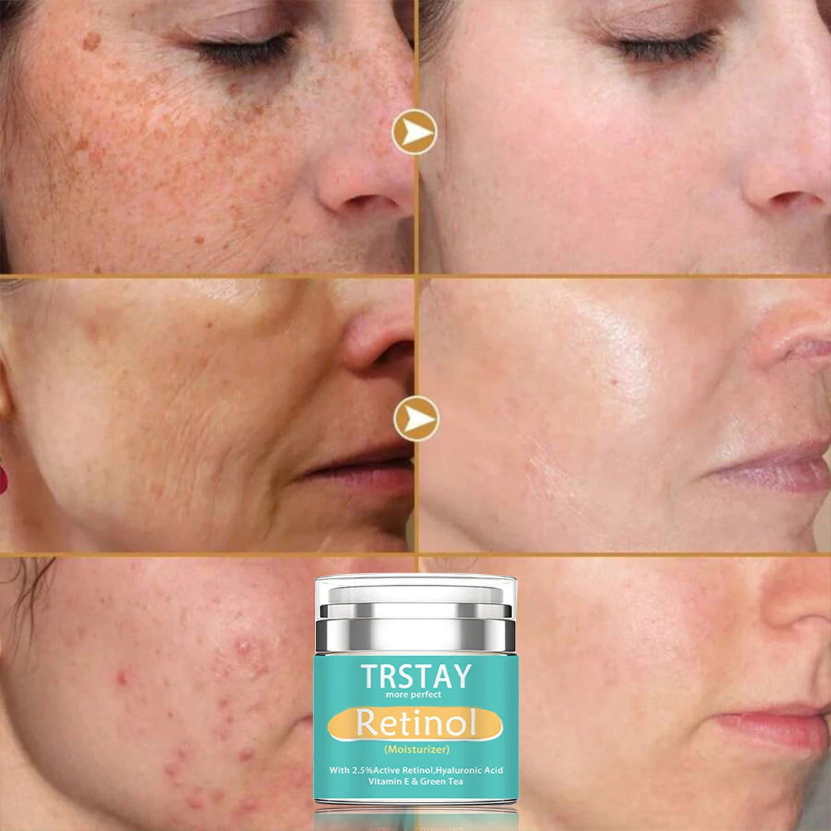 TRSTAY Retinol Moisturizing Cream 2.5% Active Hyaluronic Acid Vitamin E Green Tea Face Cream Nourishing Skin Care