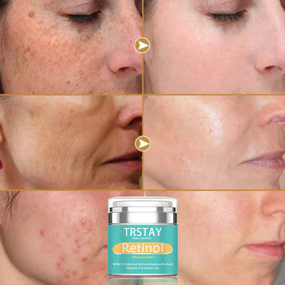 TRSTAY Retinol Moisturizing Cream 2.5% Active Hyaluronic Acid Vitamin E Green Tea Face Cream Nourishing Skin Care