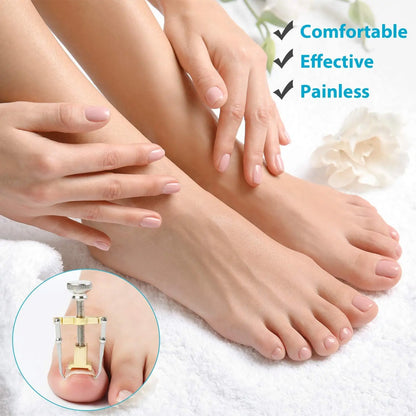 Medical Ingrown Toenail Correction Brace Kit for Quick Relief - Smarsty