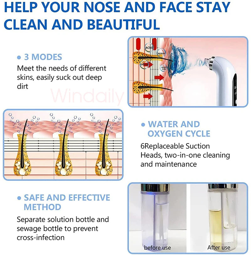 2025 Rechargeable Blackhead Remover Pore Vacuum Cleaner - Smarsty