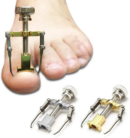 Medical Ingrown Toenail Correction Brace Kit for Quick Relief - Smarsty
