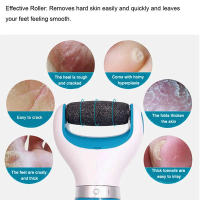 Pedi Hard Skin Remover Rollers for Effective Foot Care - Smarsty
