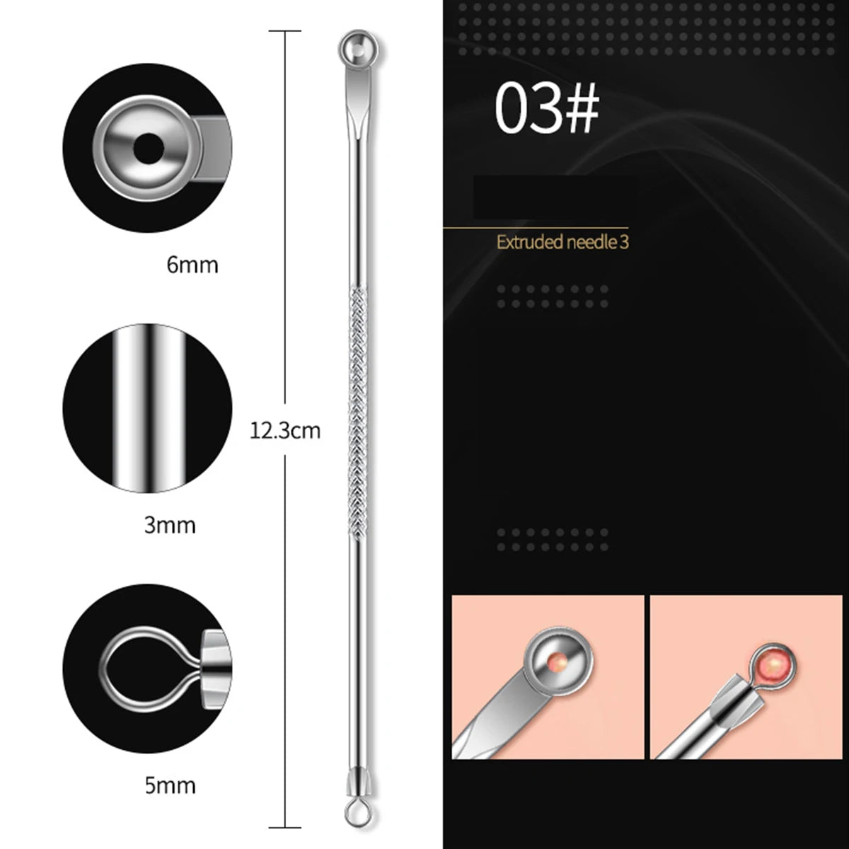 4PCS Acne Remover Tool Set for Clear Skin - Smarsty