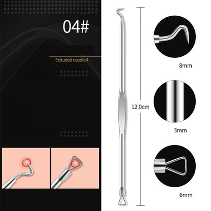 4PCS Acne Remover Tool Set for Clear Skin - Smarsty