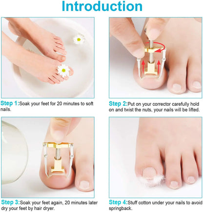 Medical Ingrown Toenail Correction Brace Kit for Quick Relief - Smarsty