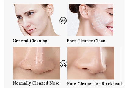 Ultrasonic Skin Scrubber for Deep Cleansing and Rejuvenation - Smarsty