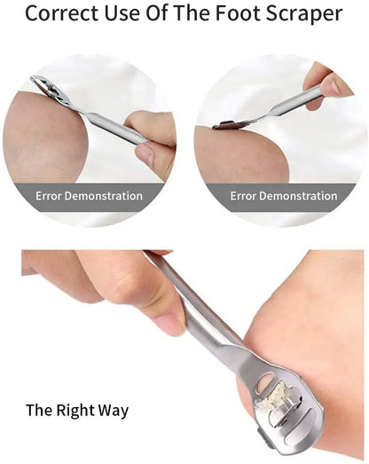 Stainless Steel Foot Callus Shaver for Smooth Skin - Smarsty