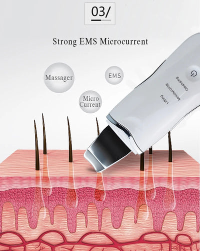 Ultrasonic Skin Scrubber for Deep Cleansing and Rejuvenation - Smarsty