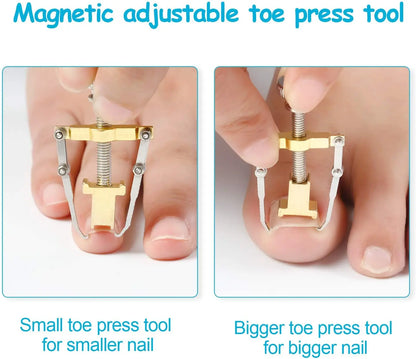 Medical Ingrown Toenail Correction Brace Kit for Quick Relief - Smarsty