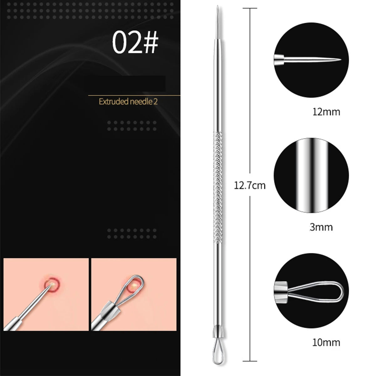 4PCS Acne Remover Tool Set for Clear Skin - Smarsty