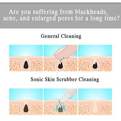 Ultrasonic Skin Scrubber for Deep Cleansing and Rejuvenation - Smarsty