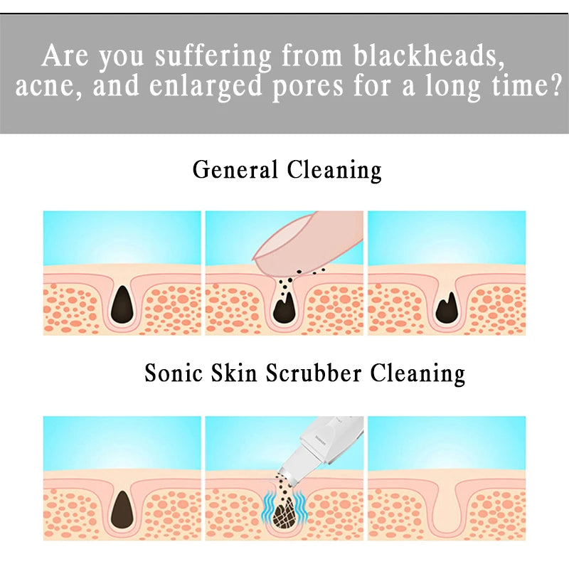 Ultrasonic Skin Scrubber for Deep Cleansing and Rejuvenation - Smarsty