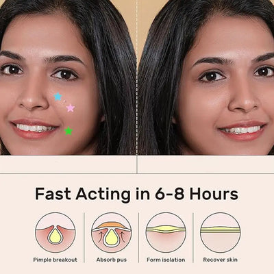 Colorful Star Acne Patches for Spot Treatment - Smarsty