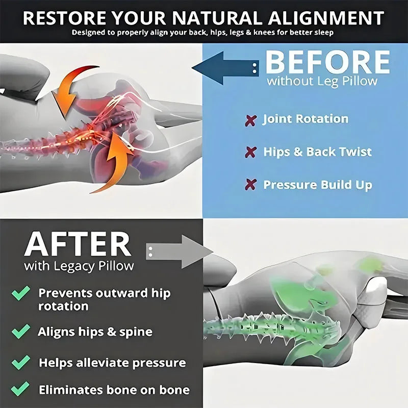 Ergonomic Leg Support Pillow for Sciatica Relief - Smarsty