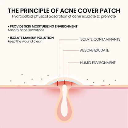 Effective Acne Repair Patch for Fading Blemishes - Smarsty