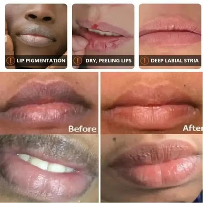 Dark Lip Lightening Balm for Moisturizing and Exfoliating - Smarsty