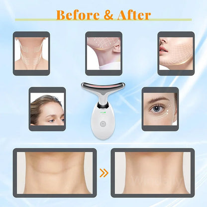 7 Colors Anti Wrinkle Facial Massager for Skin Tightening - Smarsty