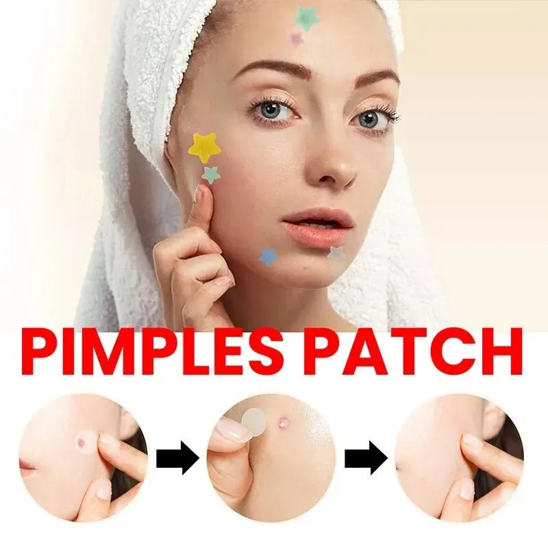Effective Acne Repair Patch for Fading Blemishes - Smarsty