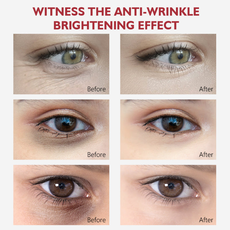 Nicotinamide Eye Cream for Dark Circles and Puffiness - Smarsty
