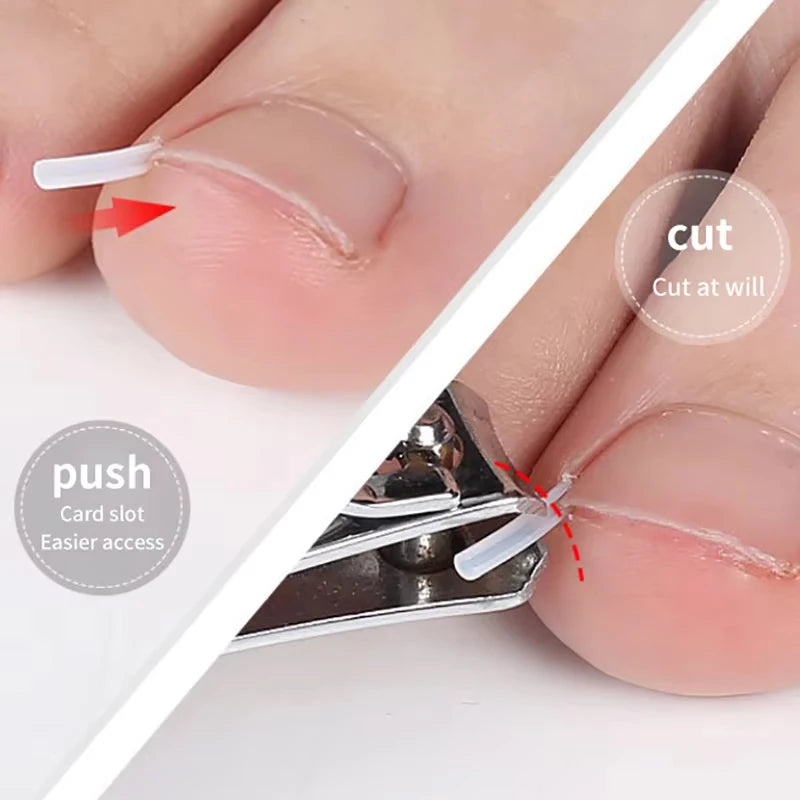 50Pcs Ingrown Toenail Correction Pads for Pain Relief - Smarsty
